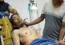 Seorang Warga Tapalang Desa Orobatu Mamuju Diterkam Buaya Saat Mancing.